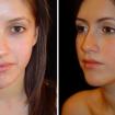 0900-2011-0324-before-after-angeline.jpg